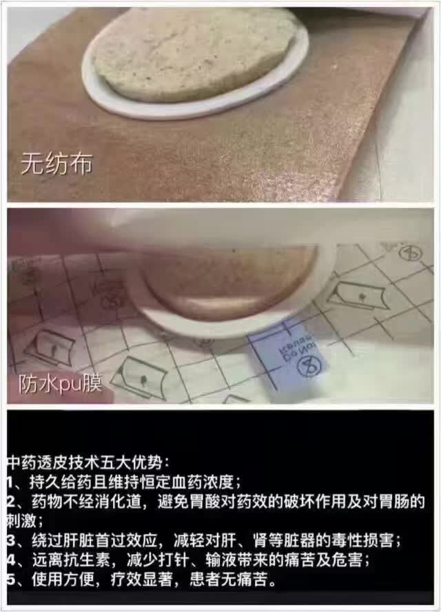 医用冷敷贴